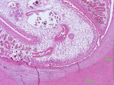 FASCIOLA-MICRO.jpg